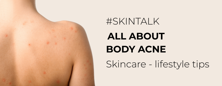 Skincare Tips for Body Acne: from Cleansing to Non-Skincare Tips