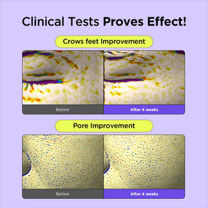 Lit & Lift Duo - By Wishtrend Malaysia