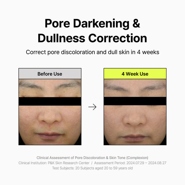 Pore Smoothing Bakuchiol Serum 30ml - By Wishtrend Malaysia