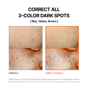 Mandelic Acid Dark Spot Correcting Serum 30ml - By Wishtrend Malaysia