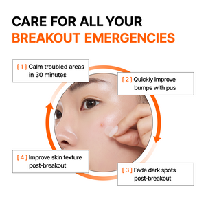 Mandelic Acid Spot Clearing Patch 39 patches - By Wishtrend Malaysia