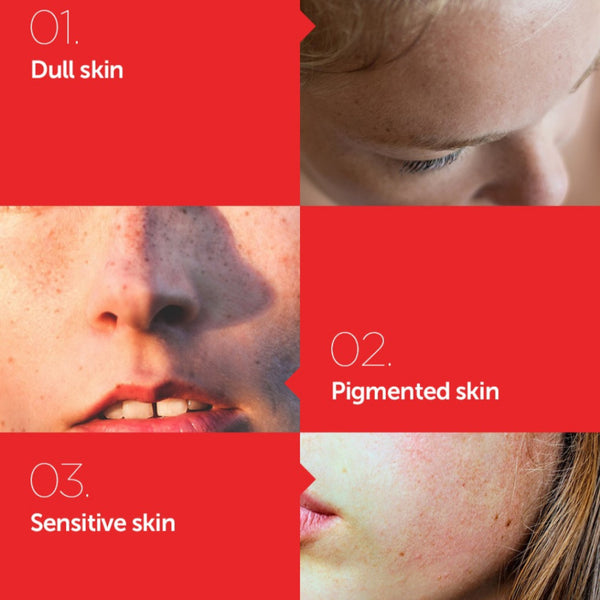 Natural Vitamin 21.5% Enhancing Sheet Mask 23ml