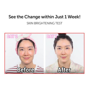 Natural Vitamin 21.5% Enhancing Sheet Mask 23ml