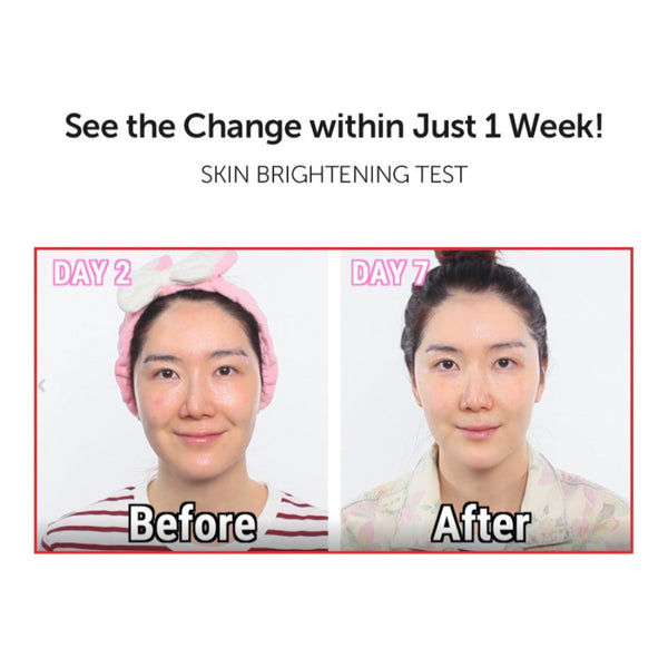 Natural Vitamin 21.5% Enhancing Sheet Mask 23ml